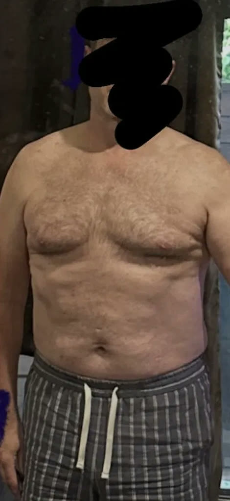Steven before